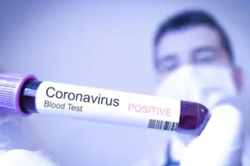 Koronawirus: w powiecie gryfickim jedna osoba już wyzdrowiała