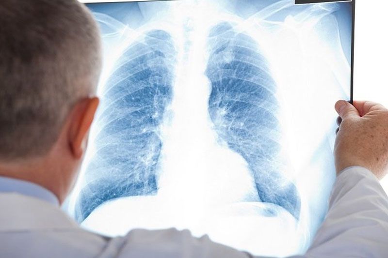 Bezpłatne badania płuc dla mieszkańców Gryfic